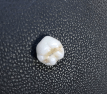 Screen Shot 2017-11-28 at 11.20.12 AM